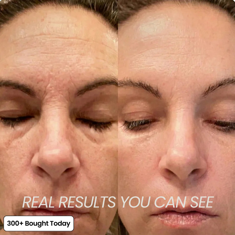 The 2-Step Korean Secret That’s Replacing Botox for 173,000+ Women