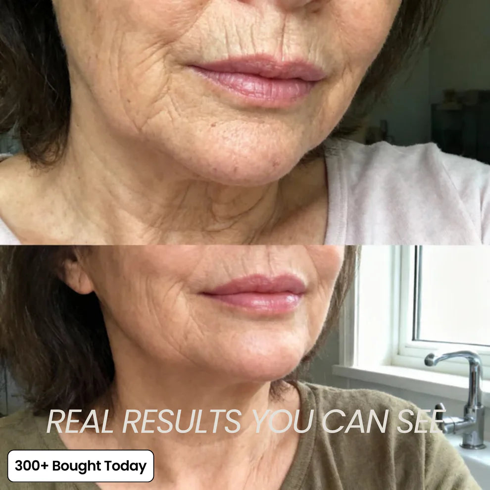 The 2-Step Korean Secret That’s Replacing Botox for 173,000+ Women
