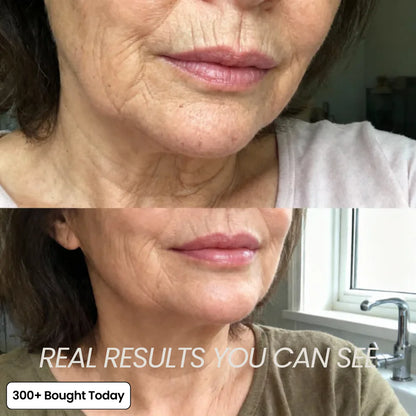 The 2-Step Korean Secret That’s Replacing Botox for 173,000+ Women
