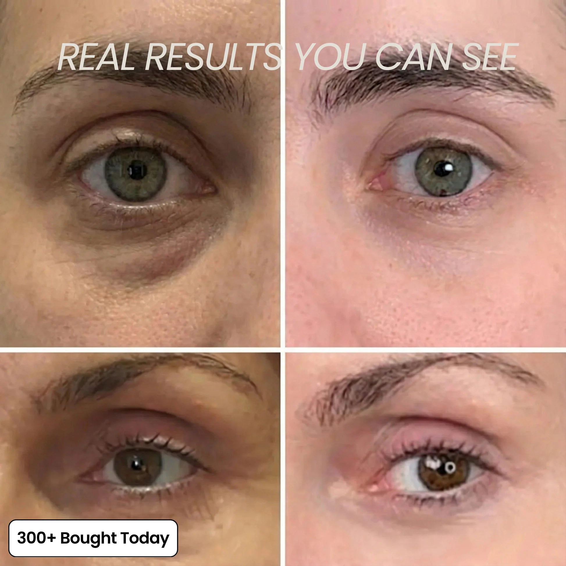 The 2-Step Korean Secret That’s Replacing Botox for 173,000+ Women