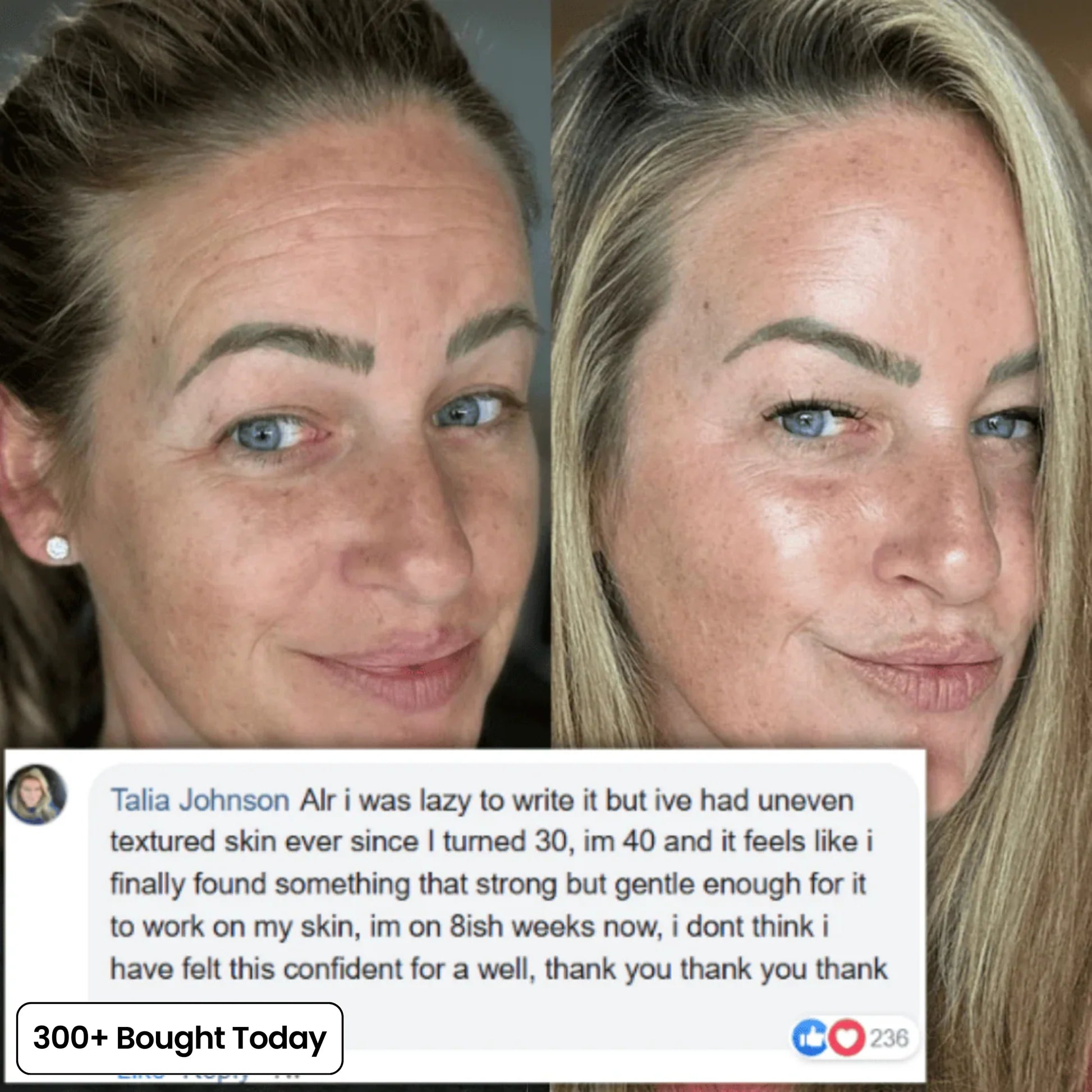 The 2-Step Korean Secret That’s Replacing Botox for 173,000+ Women