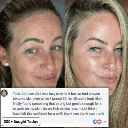 The 2-Step Korean Secret That’s Replacing Botox for 173,000+ Women