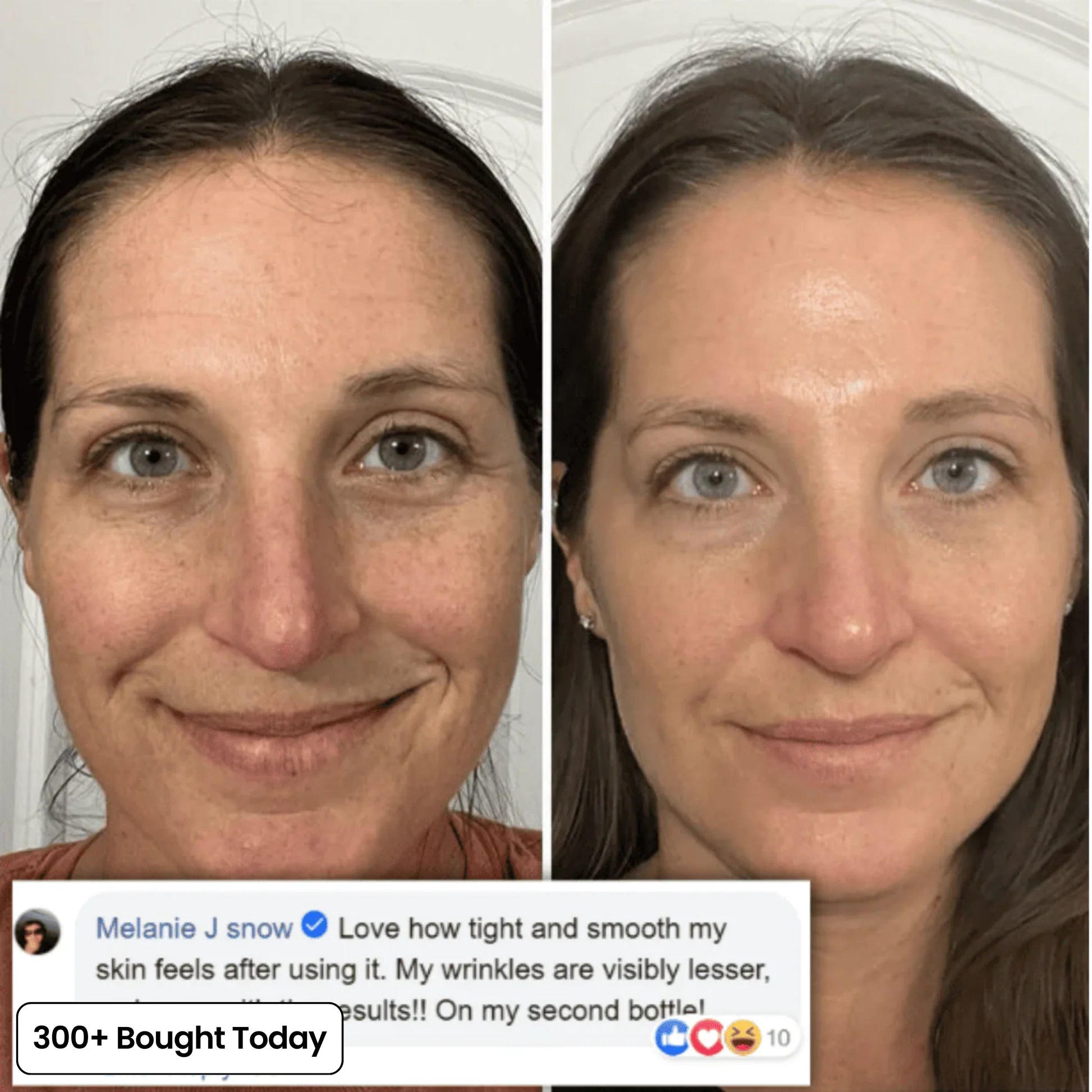 The 2-Step Korean Secret That’s Replacing Botox for 173,000+ Women