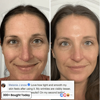 The 2-Step Korean Secret That’s Replacing Botox for 173,000+ Women